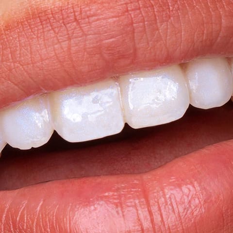 Crest 3D Whitestrips Gentle